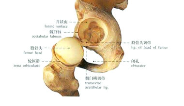 人工髋关节置换术的优缺点